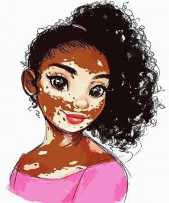 Vitiligo Girl Diamond Painting