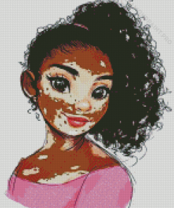 Vitiligo Girl Diamond Painting